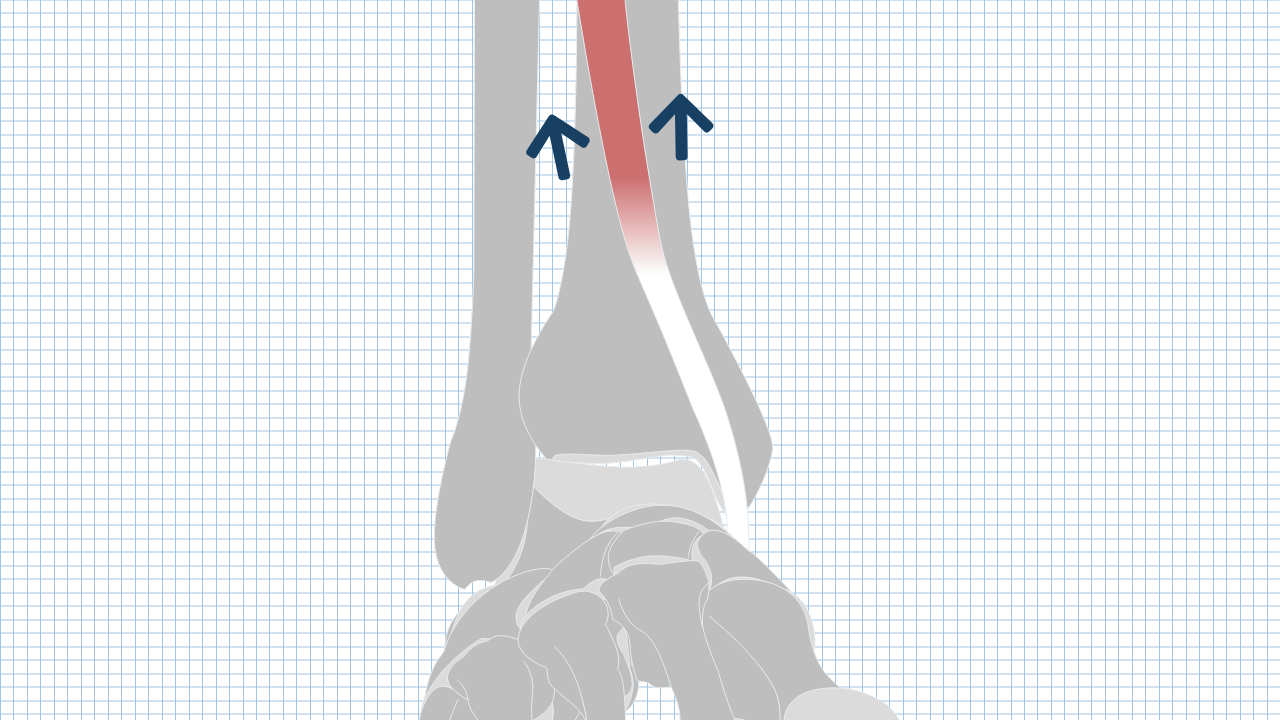 【運動器リハのすゝめ】前脛骨筋・長母趾伸筋・長趾伸筋・第3腓骨筋の解剖と機能