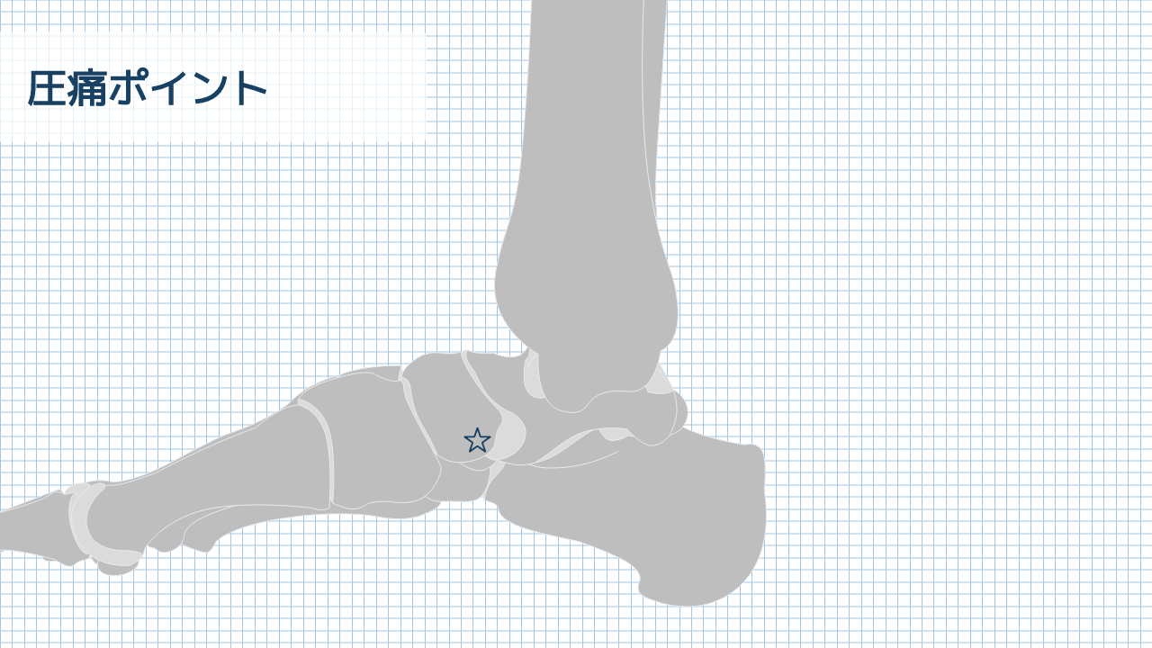 【運動器リハのすゝめ】足部・足関節の圧痛検査