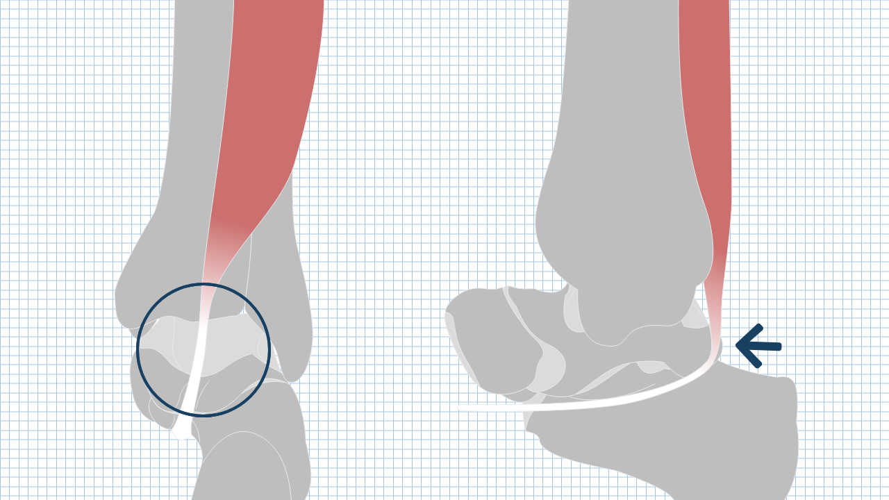 【運動器リハのすゝめ】後脛骨筋・長母趾屈筋・長趾屈筋の解剖と機能